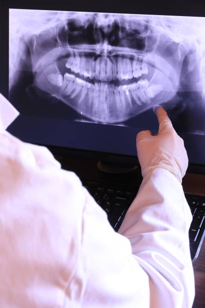 Best Emergency Broken Tooth Repair in Bloomington, IL